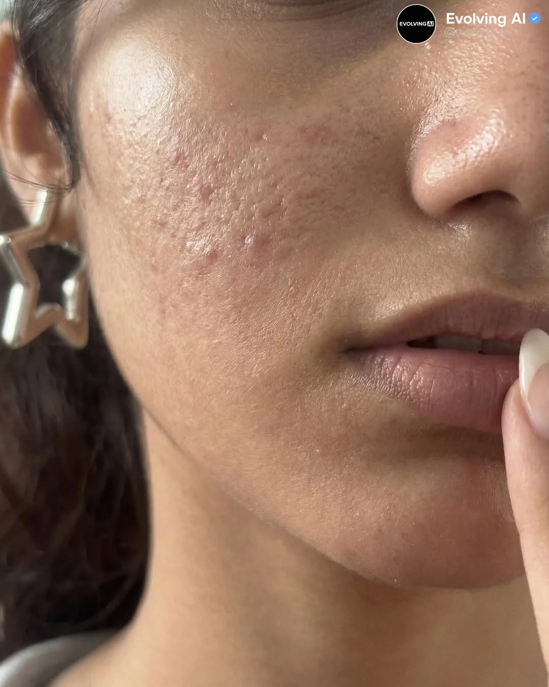 Thumbnail of www-instagram-com-p-dutpihocd2e-img-index-6 2