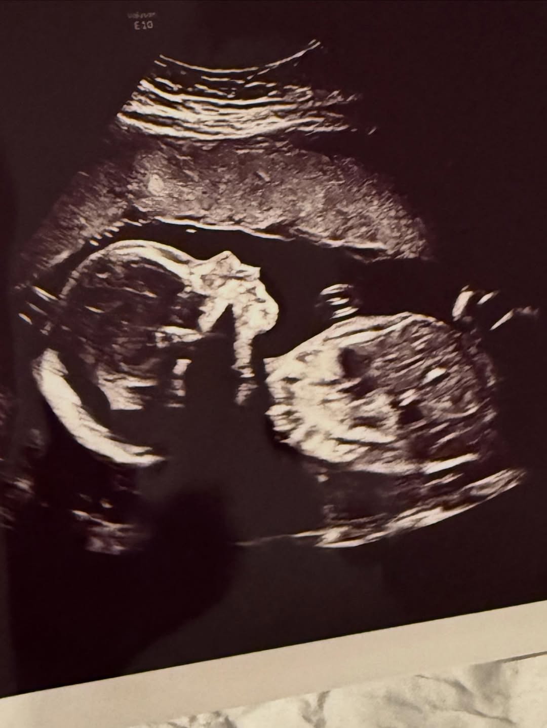 Thumbnail of www-instagram-com-p-ds6hy8xeynl-img-index-4 12