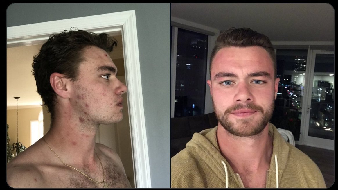 Thumbnail of www-x-com-meatmafiabrett-status-1596516209729470464-5369557bbd6d449b