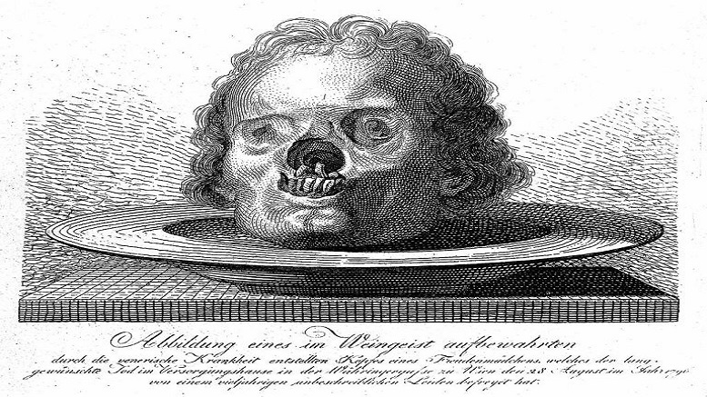 Thumbnail of Venereal Disease and the Prostitution Policy of the British Raj