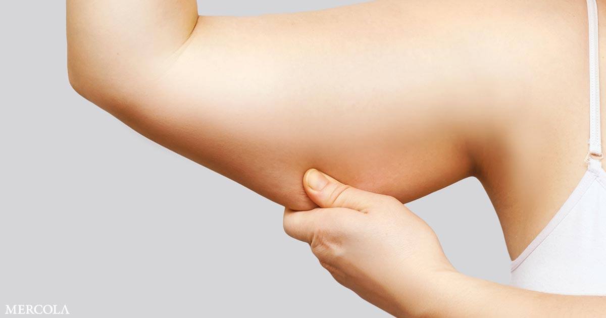 Thumbnail of How High-Fat Diets Fuel the Spread of Cancer