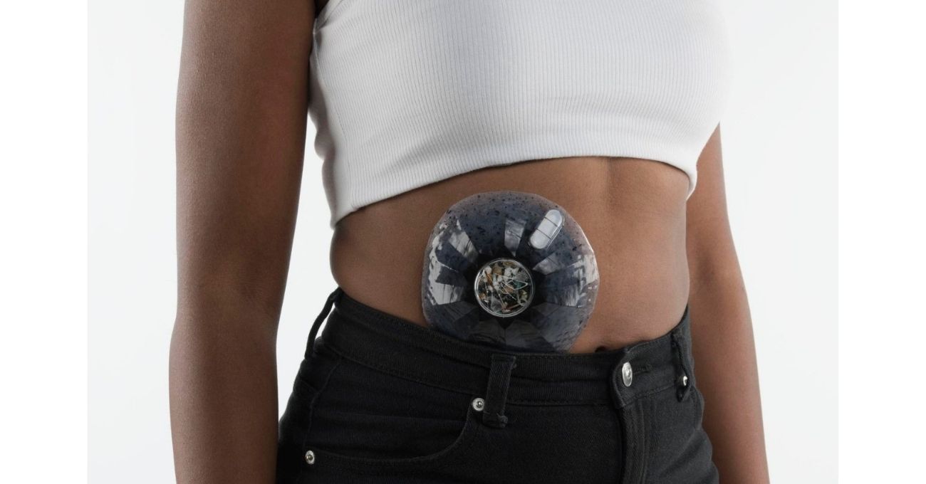 Thumbnail of 79. Organ: Mikroplastik Detoksu Üzerinden Geleceği Sorgulamak • Bigumigu