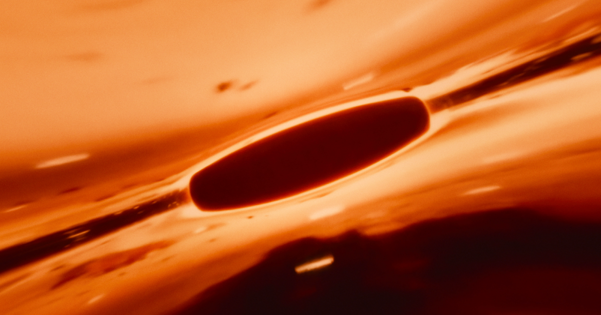 Thumbnail of Our partnership with Darren Aronofsky’s Primordial Soup