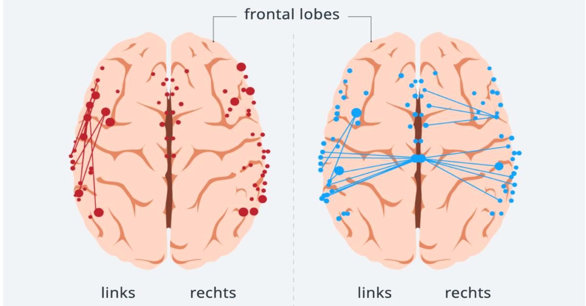 Thumbnail of Language and language acquisition: How the brain processes German and Arabic | Qantara.de