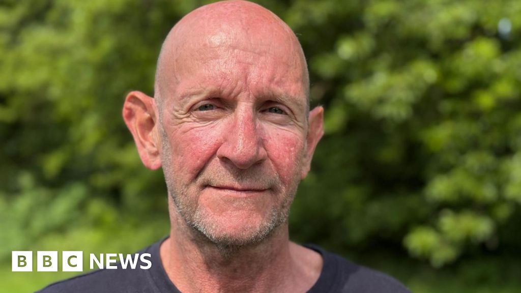 Thumbnail of Alcohol-related brain damage could affect thousands, warns expert