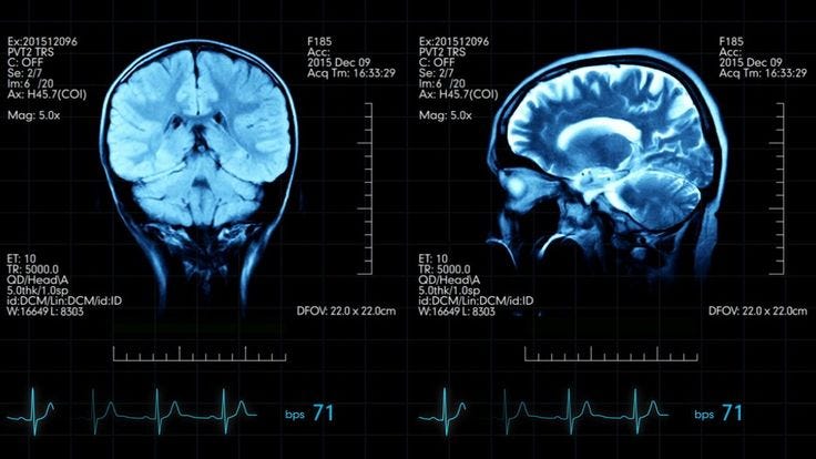 Thumbnail of The Conscious And Subconscious Mind: Everything You Need To Know