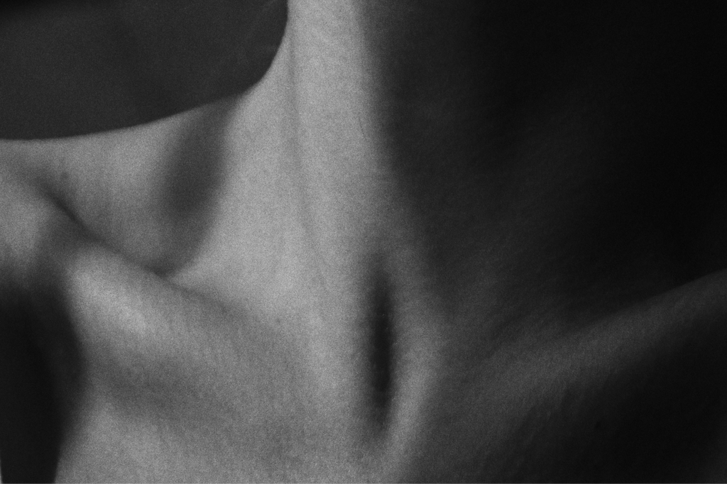 Thumbnail of The Link Between Lymphatics and Resilience